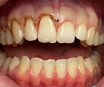Perfectsmile Coaching für Zahnärzte - Milan Michalides - becomePro