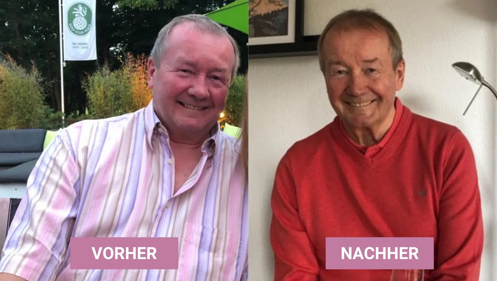 Kurt Vorher-Nachher-Vergleich, Gewichtsabnahme Keto Erfolgsbeispiel