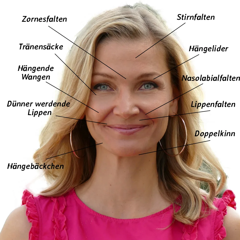 Chi statt Botox – Videokurs für Gesichtsyoga von Christina Schmied 2 Anatomische Gesichtsdiagramm mit Beschriftung von Zornesfalten, Stirnfalten, Nasolabialfalten, Hängeliedern und weiteren Prob