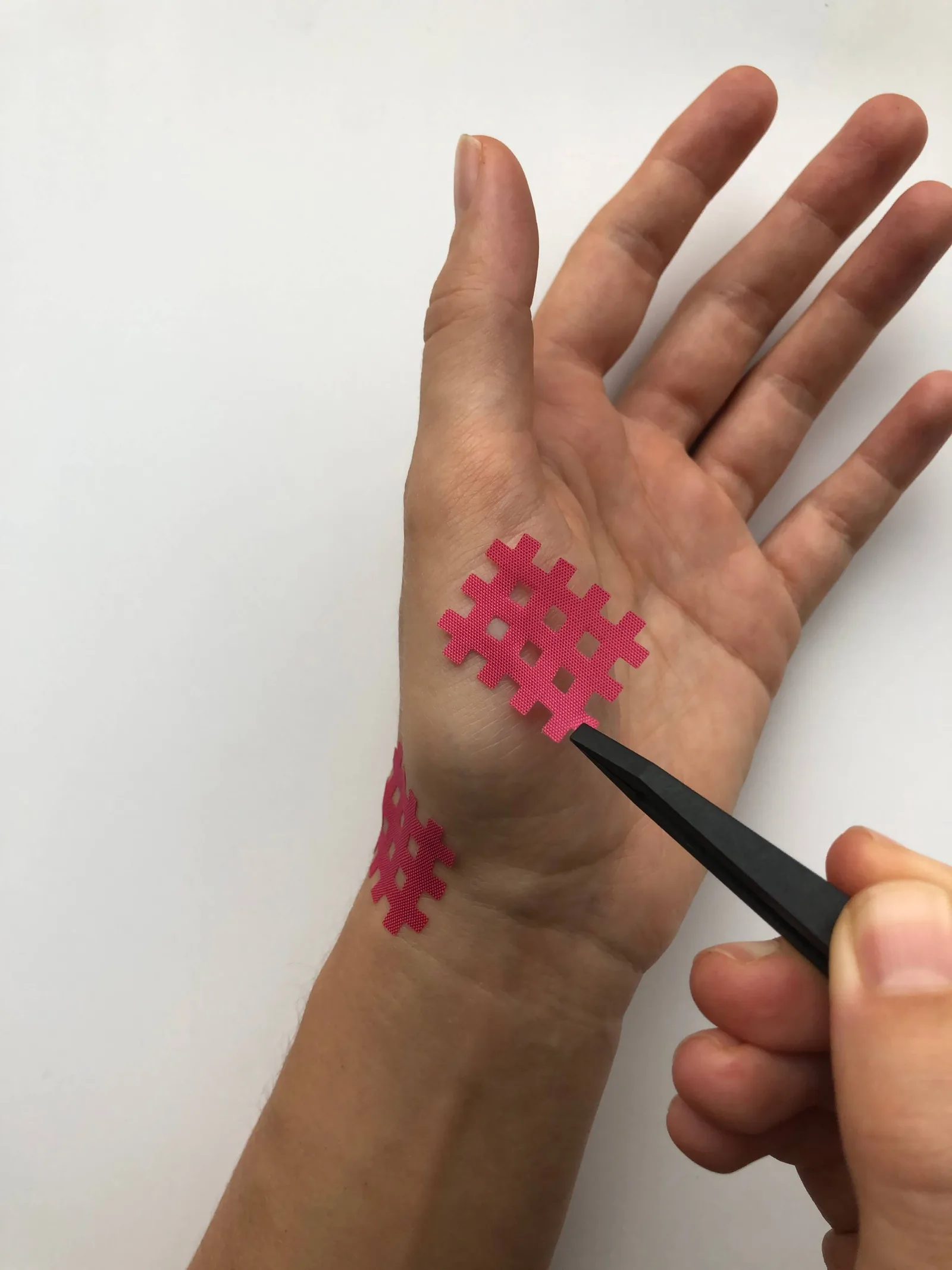Hand mit roten Kinesio-Tapes in Gitternetz-Muster, therapeutische Anwendung bei CRPS