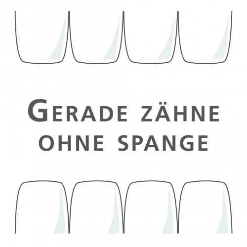 Illustration von geraden Zähnen ohne Spange, oben schmale und unten breite Zahnform
