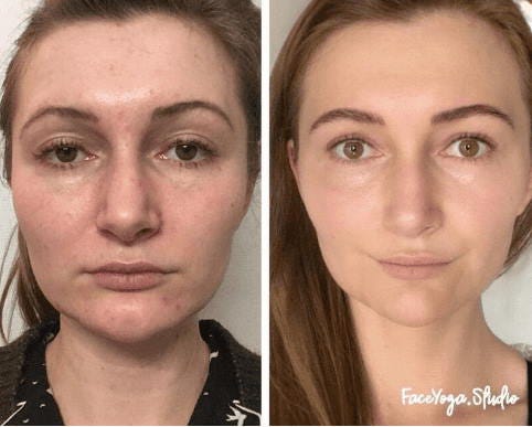 Vorher-Nachher Vergleich Gesichtsyoga Ergebnisse einer Frau mit strahlerer Haut