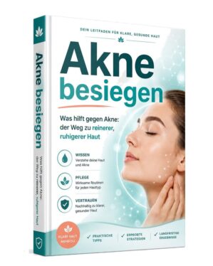 Cover – Akne besiegen: PDF-Ratgeber von RatgeberPlatz.de
