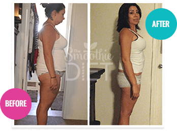 Vorher-Nachher-Foto einer Frau mit Gewichtsverlust-Ergebnis, Before/After Vergleich