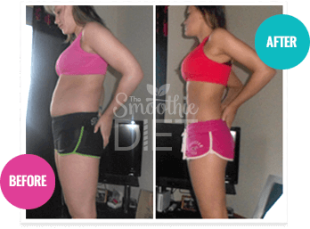 Vorher-Nachher-Foto einer Frau mit Gewichtsverlust-Ergebnis, Before/After Vergleich
