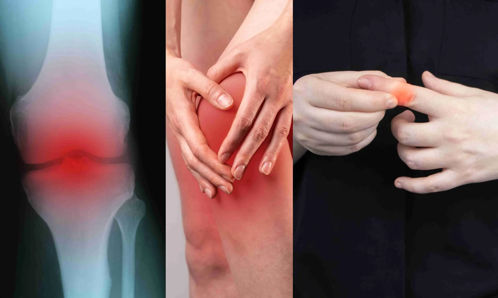 Montage von Gelenkschmerzen: Röntgenbild Knöchel, Handgelenk, Finger und Knie mit roter Schmerzmarkierung