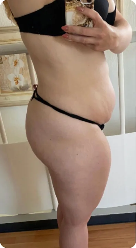 Schwangere Frau mit Babybauch im Spiegel, Vorher-Bild