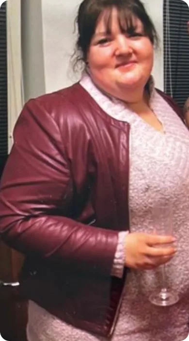 Übergewichtige Frau in Burgunderjacke und grauem Shirt, Vorher-Bild