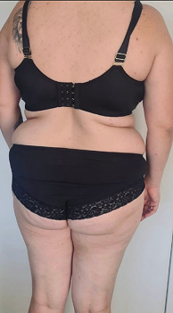 Frau von hinten in schwarzer Unterwäsche, Vorher-Bild Bauch und Hüften