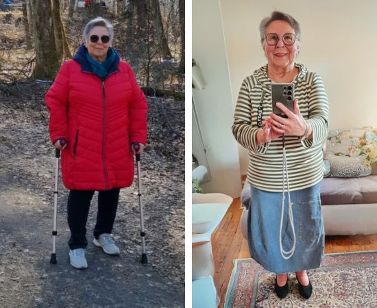 Vorher-Nachher-Vergleich einer Frau in roter Jacke und gestreifter Jacke