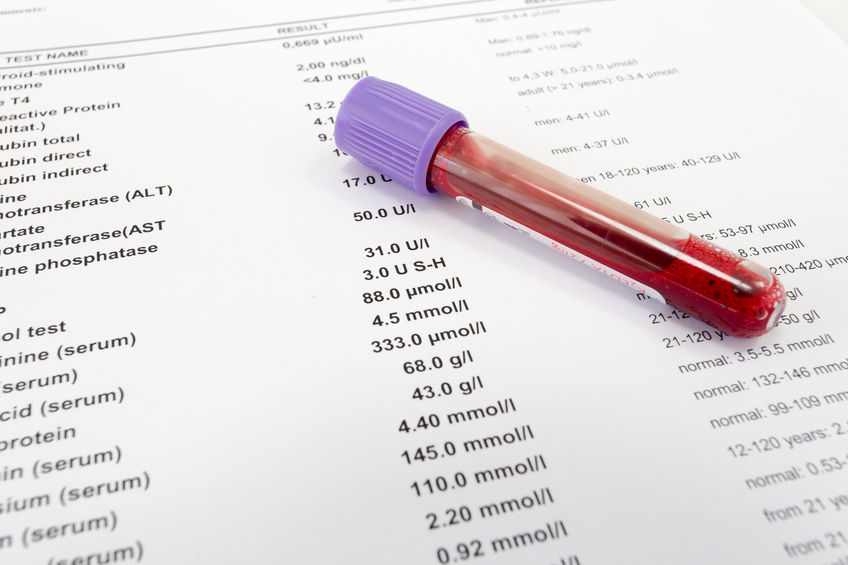Moin Veränderung – Ernährungs-Coaching zum Abnehmen 5 Red blood in test tube on white blank